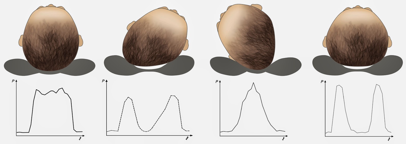 Baby Flat Head Pillows Review 10 Points To Consider Before You
