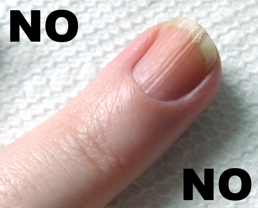 Uncracking a cracked nail. - fingernail split | Ask MetaFilter
