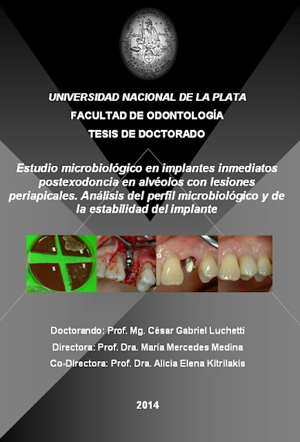 Implant related thesis 03 image