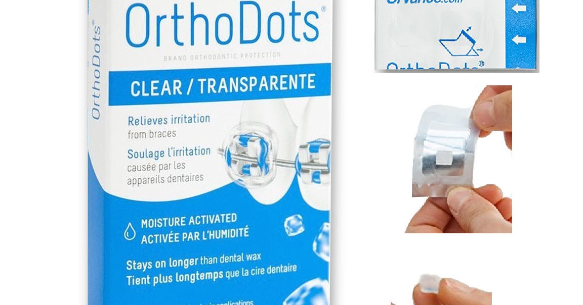 Products & Tips New OrthoDots Stops Braces From Hurting