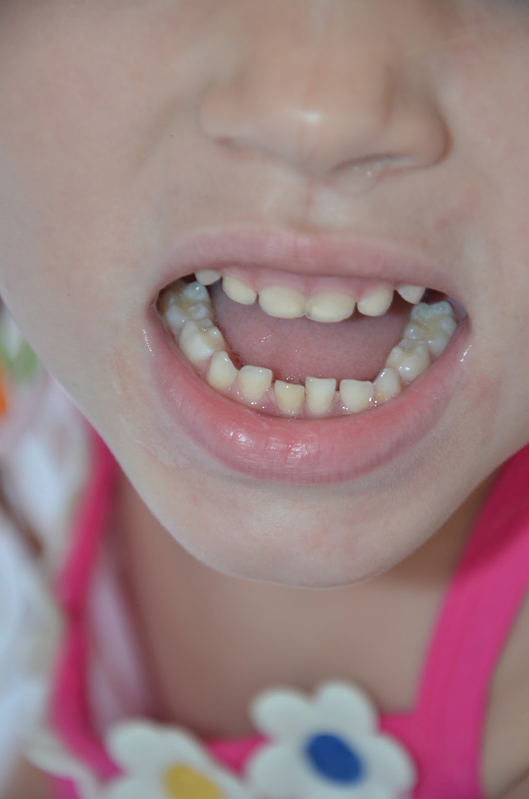 Fun with the Finger's Loose Tooth!