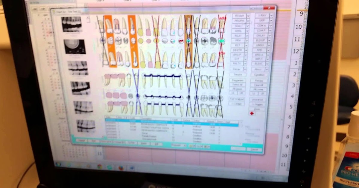 SEO Strategies: EagleSoft Training Videos