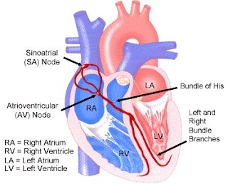 sick sinus syndrome and pacemaker sick sinus syndrome and pacemaker