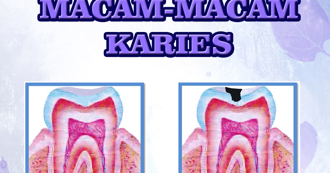 14+ Gambar Poster Tentang Kesehatan Gigi, Paling Dicari!