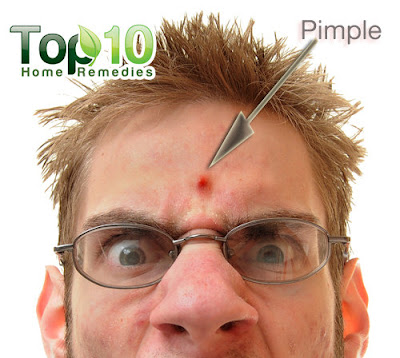 Anxious to know how to get rid of a Pimple overnight! Well, there are a variety of natural as well as usual remedies that tend to heal Pimples Immediately possible.    Read further and discern ways on how to get rid of Pimples overnight.