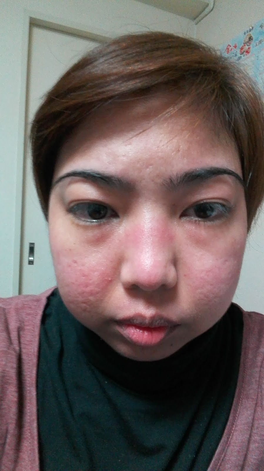 Fighting Lupus in Japan New roller coaster ride! January 2019