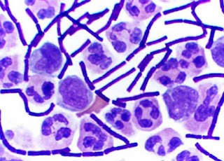 Pewarnaan Sel Bakteri