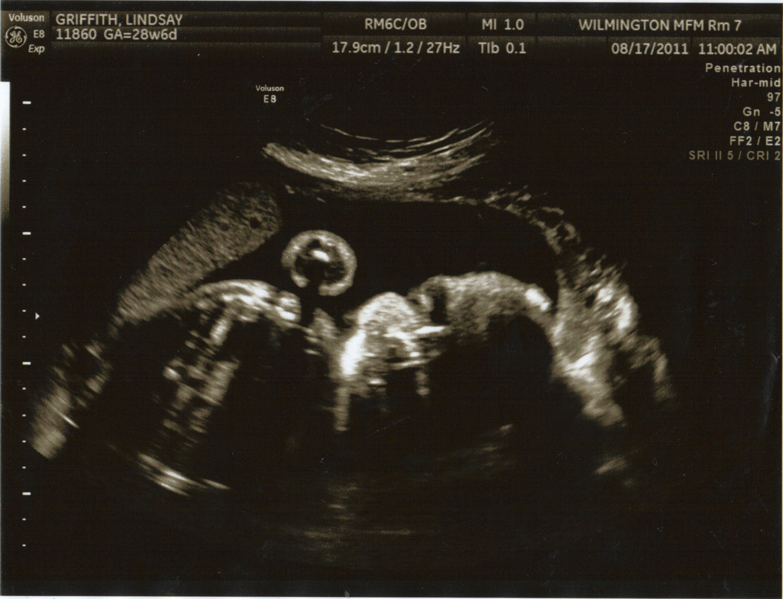 Growing Baby G! 28 Week and 6 Days ultrasound