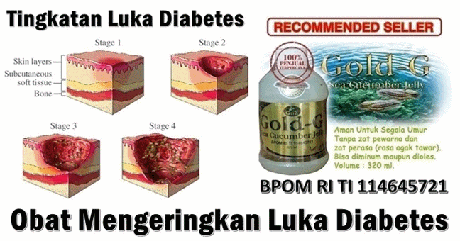 Obat untuk mengeringkan luka pada penderita diabetes