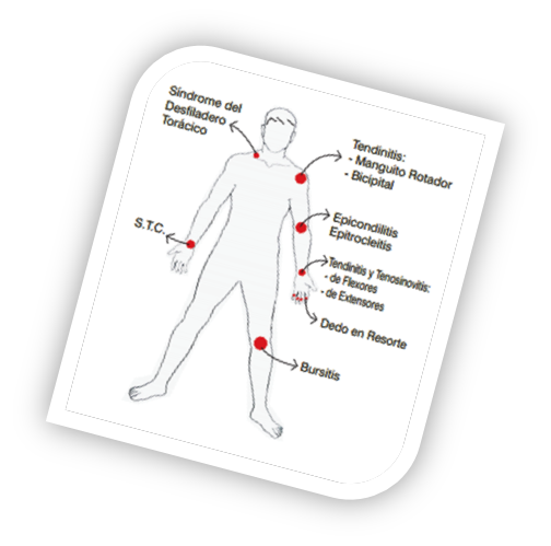 Traumatismos Musculoesqueléticos: Causas principales de las lesiones ...