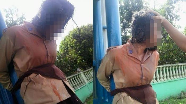 Perayaan Ultah `Alay` Kembali Memakan Korban! Lihat yang Terjadi Pada Mata Siswa Ini Perayaan Ultah `Alay` Kembali Memakan Korban! Lihat yang Terjadi Pada Mata Siswa Ini