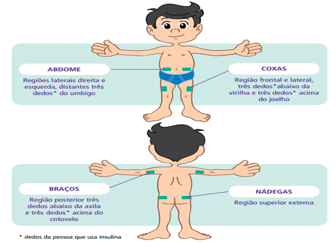 Tenho Diabetes Mellitus e o médico prescreveu insulina! | CMS Padre Miguel