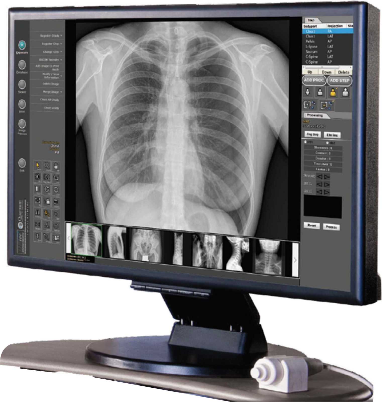 Х-ray scan v3.0. Цифровой рентген снимок. Цифровая рентгенография. Цифровая рентгеноскопия. Xray extension