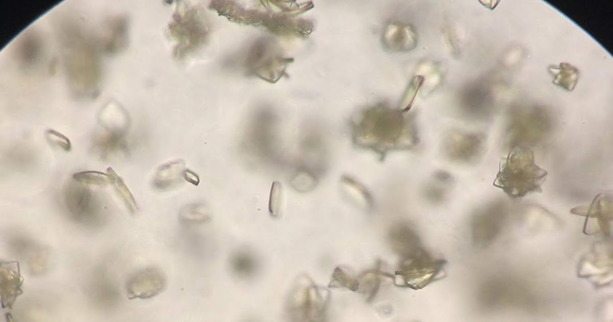 Cindy's Lab Life CLINICAL MICROSCOPY DISCOVERIES!