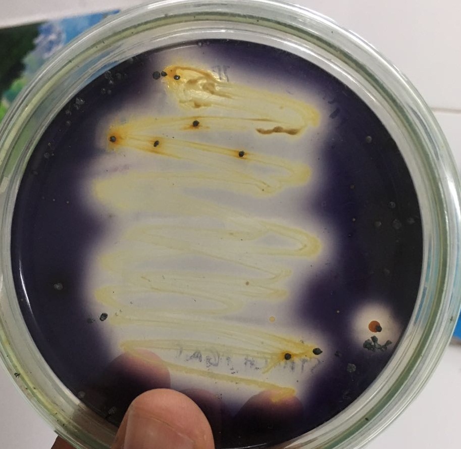 gelatin hydrolysis test for bacillus subtilis gelatin hydrolysis test for bacillus subtilis
