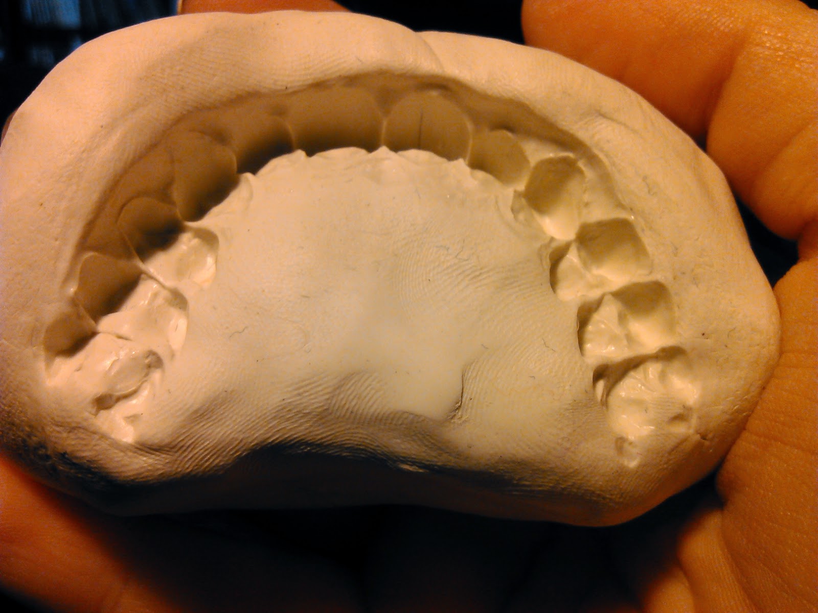 Kitsune_Crafts Acrylic fangs