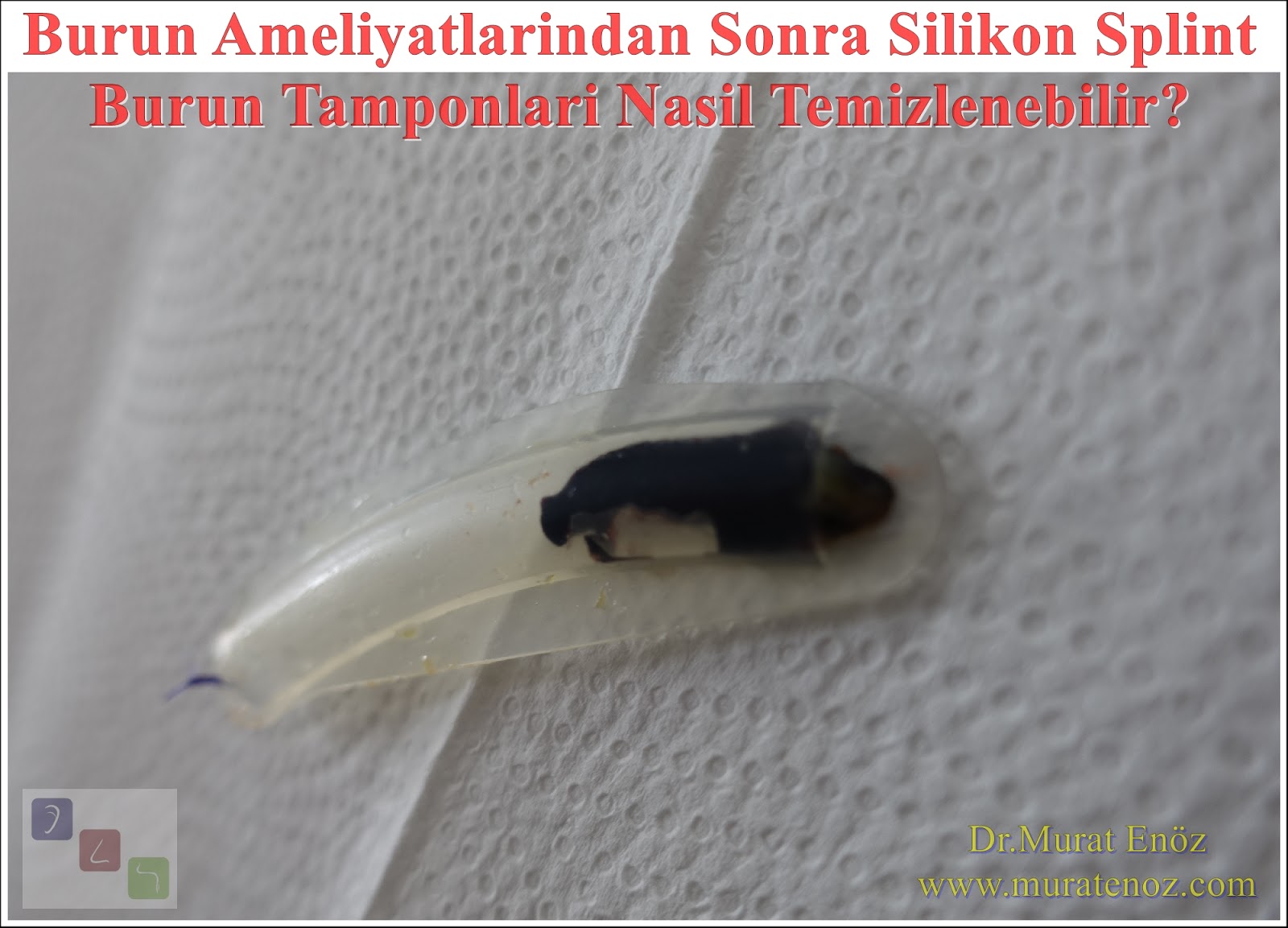 How to Clean Internal Nasal Splint After Nose Surgery?