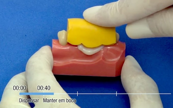 MATERIAIS DENTÁRIOS: Dicas entre uma consulta e outra - Protemp 4