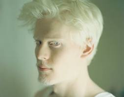 http://3.bp.blogspot.com/-2R1TO2ubyiE/T2Jdw8ntpSI/AAAAAAAAB0g/KvcBcegHBdY/s1600/hombre+albinismo.jpg