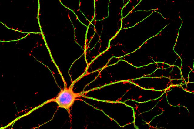 brainneuron.jpg