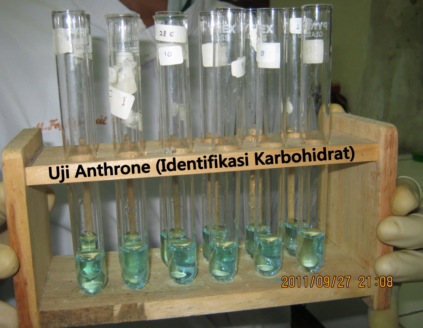 Identifikasi Karbohidrat Analis Kesehatan