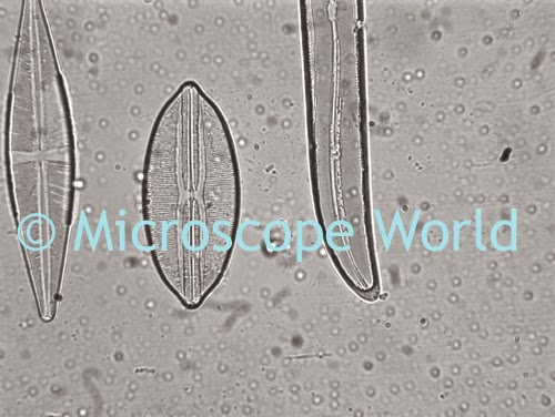 Dirty microscope lens image