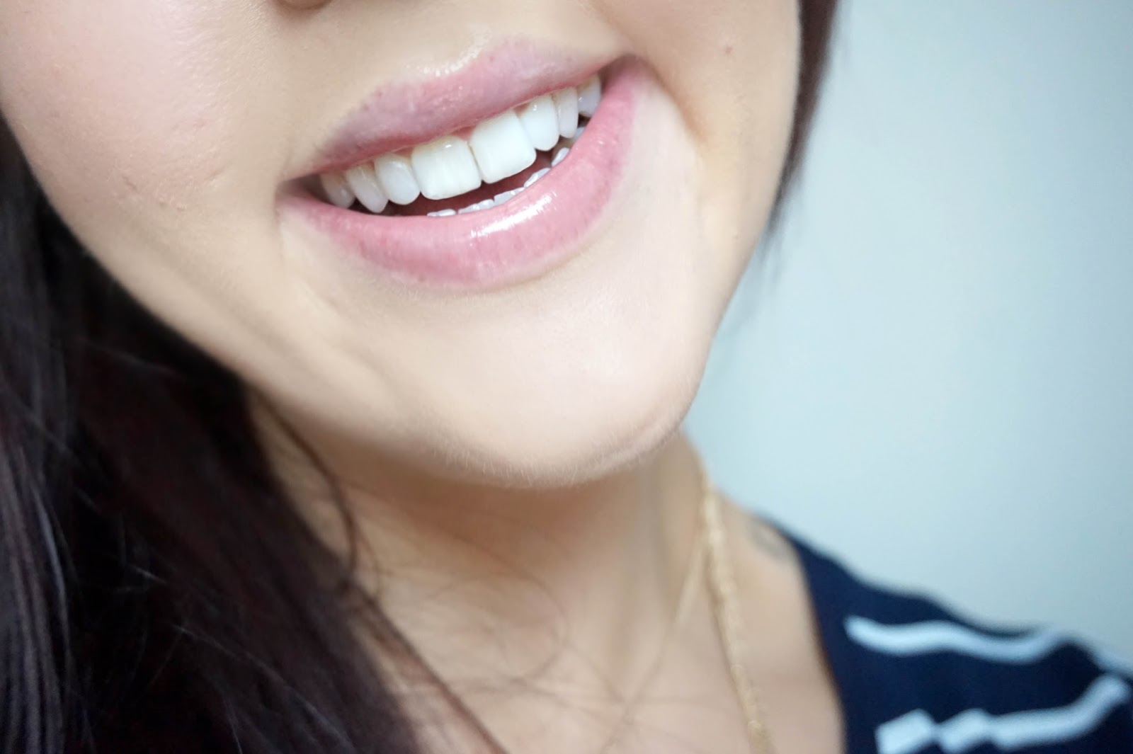 IWhite Instant Teeth Whitening Kit Review Slurp Social