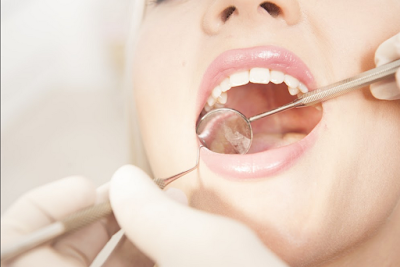 http://www.thangamsdentalclinic.org/Cavity-fillings.php