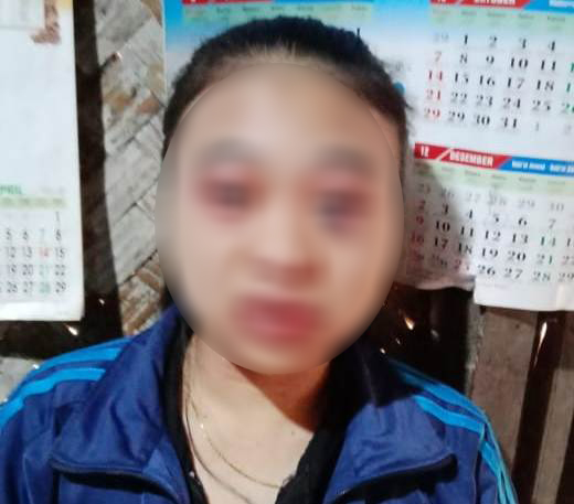 Pegawai Toko Waralaba di Sekincau, Mengaku  Nyaris Diperkosa Sosok Misterius