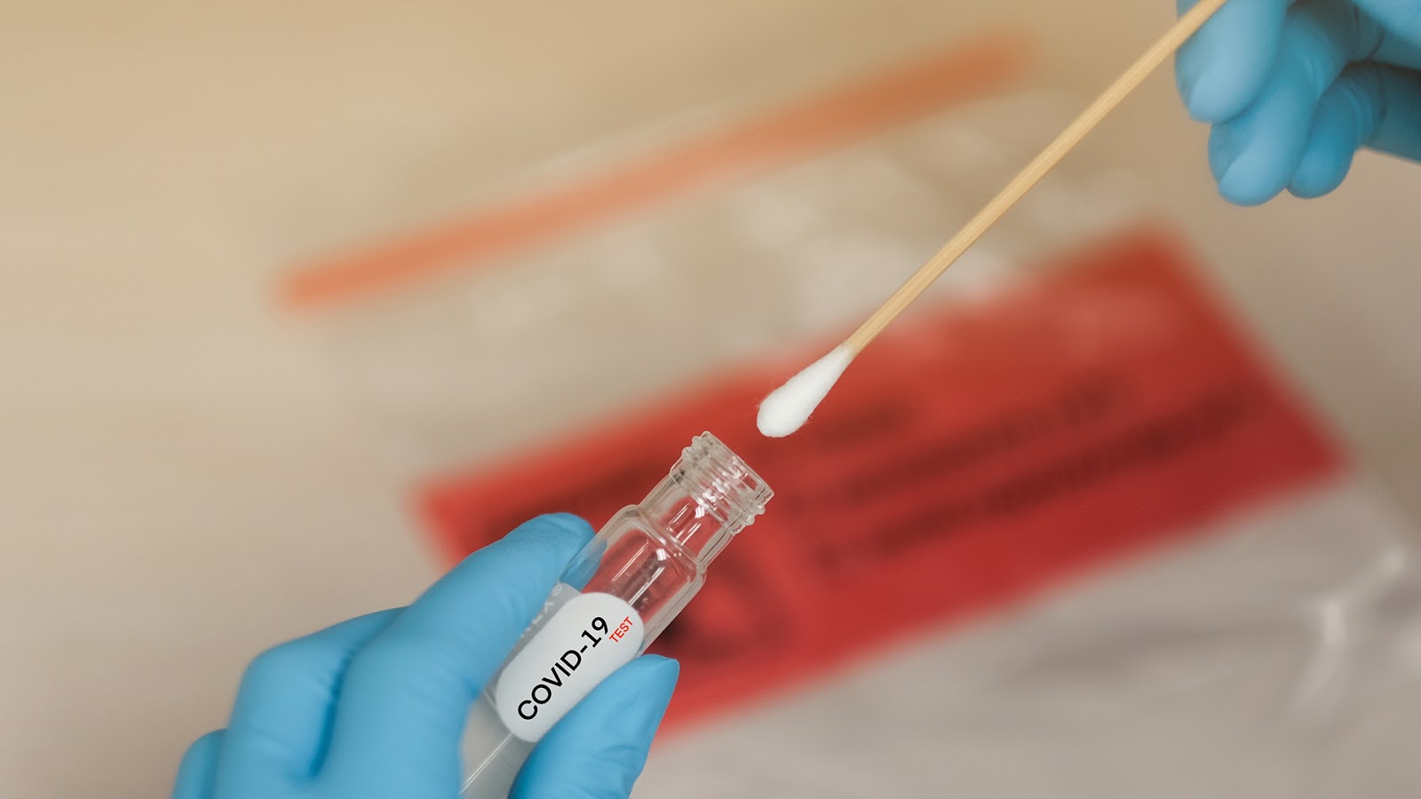 Las provincias podrán confirmar casos positivos de coronavirus por diagnostico, sin la realización de un hisopado Las provincias podrán confirmar casos positivos de coronavirus por diagnostico, sin la realización de un hisopado