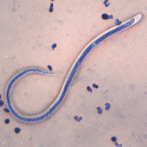 contoh hewan filum nemathelminthes férgek megelőzése felnőttek népi gyógymódok