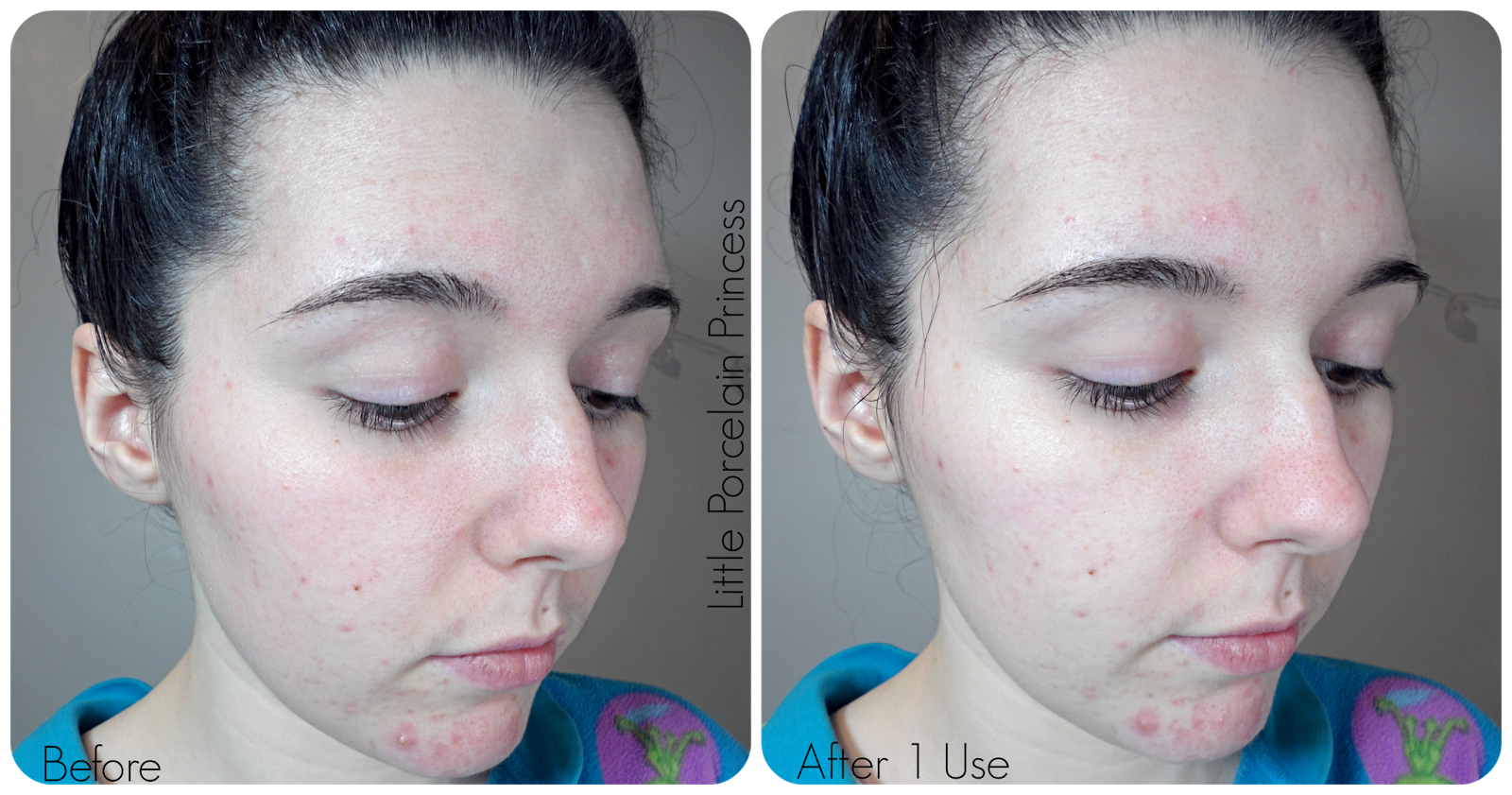 Little Porcelain Princess Review & Giveaway Annies' Way; Arbutin