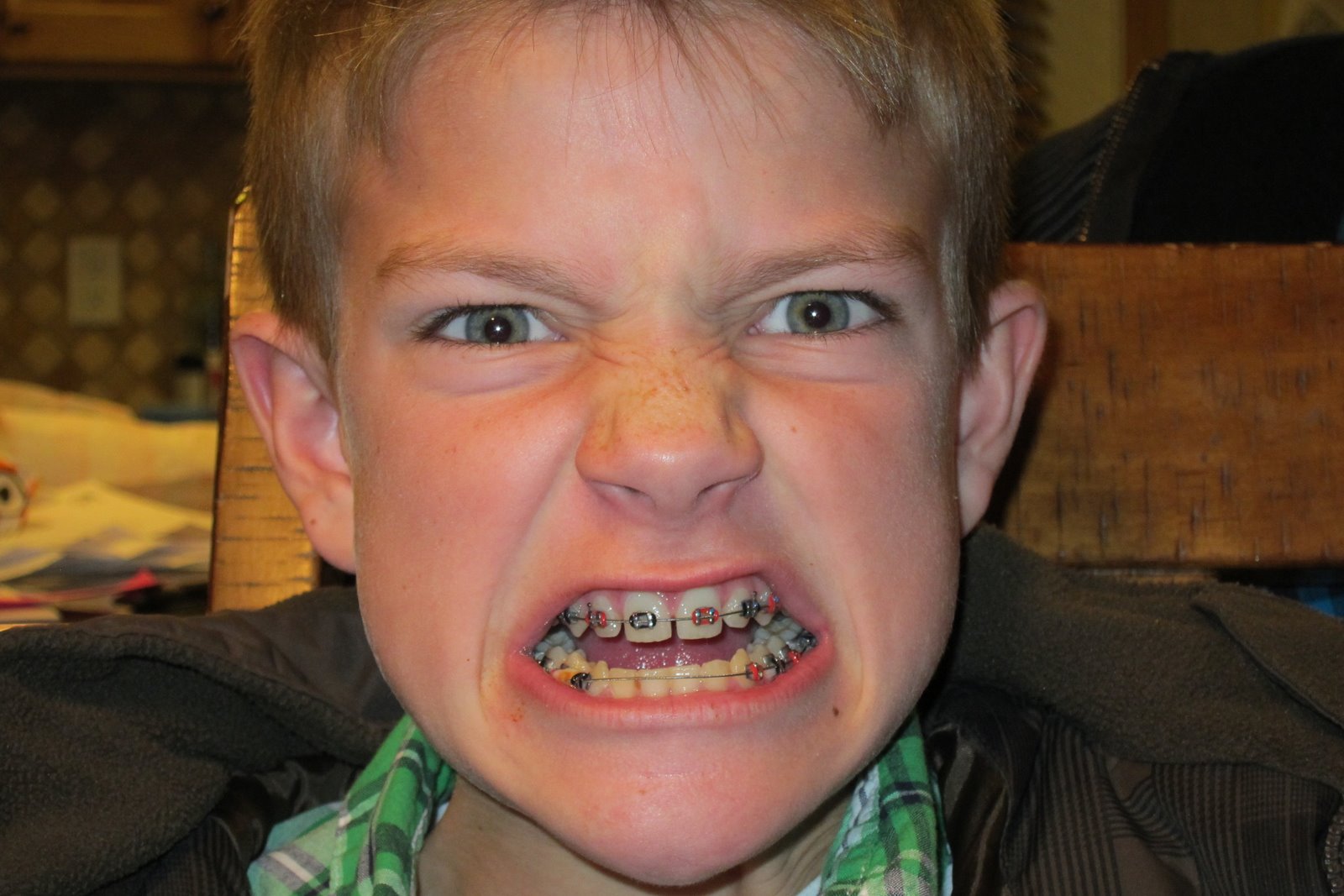 Diane's Fun Family Blog Brothers in Braces