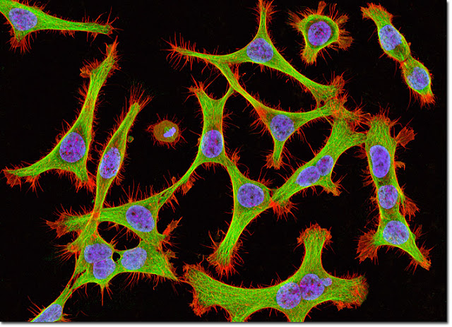 www.fertilmente.com.br - Células HeLa vistas por um microscópio de alta resolução, estas células vem são basicamente imortais, mas mataram sua hospedeira