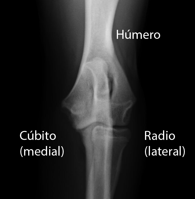 ARTROVET Fractura del proceso lateral del cóndilo humeral ARTROVET Fractura del proceso lateral del cóndilo humeral