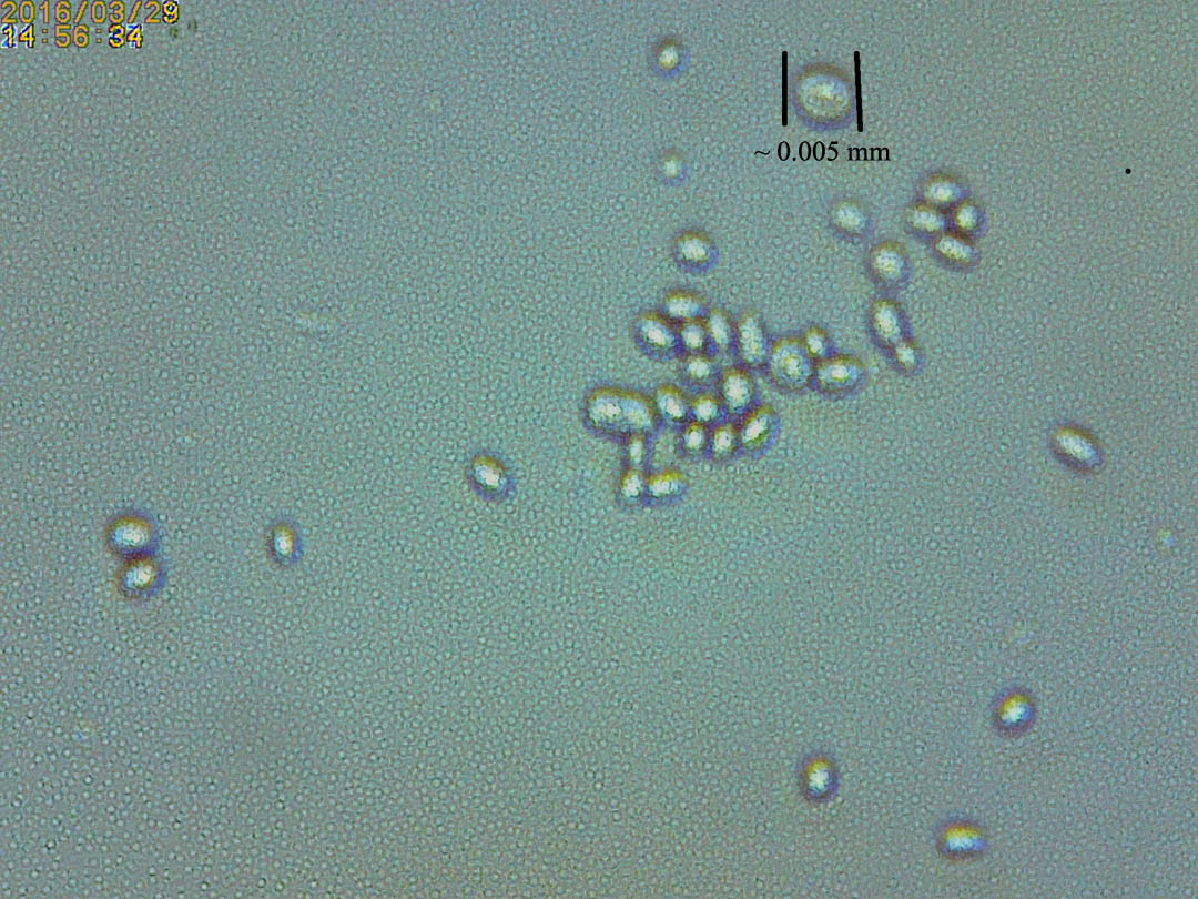 Yeast Cells Under Microscope 400x Micropedia