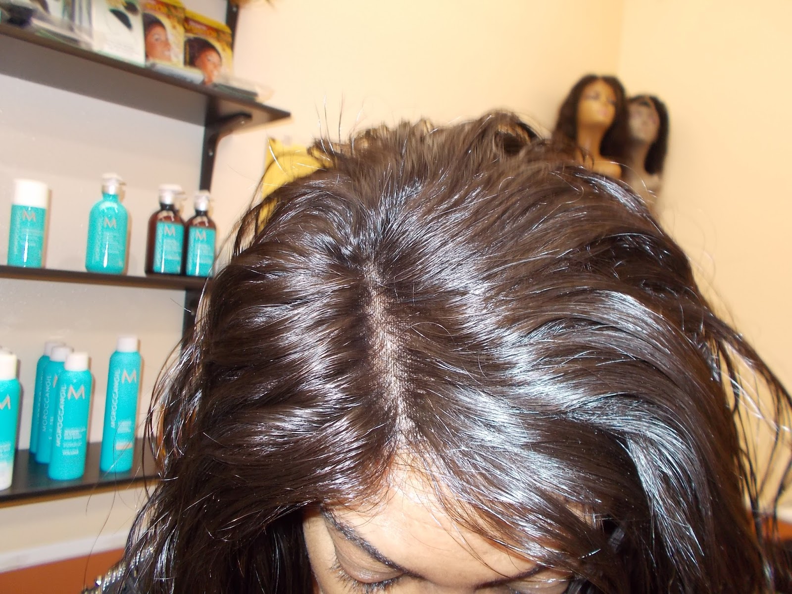 Hair Replacement Orlando