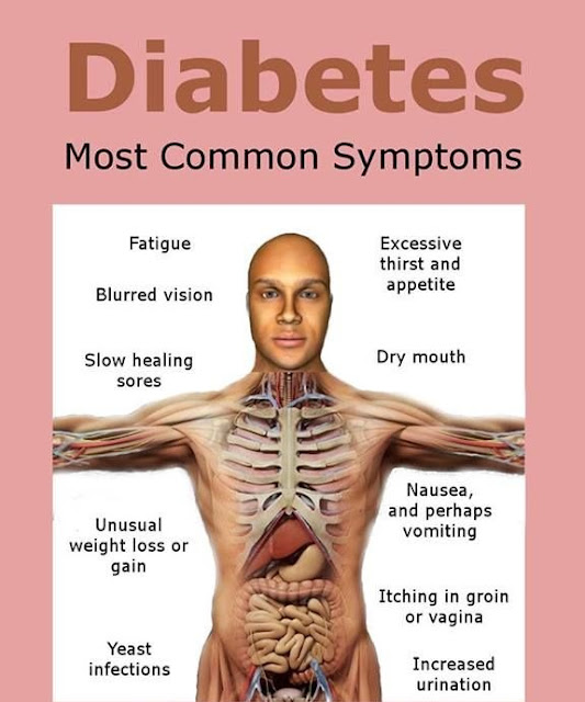 Medical And Health Science Common Diabetes Symptoms