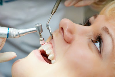 Cạo vôi răng định kỳ bao lâu áp dụng 1 lần? 2