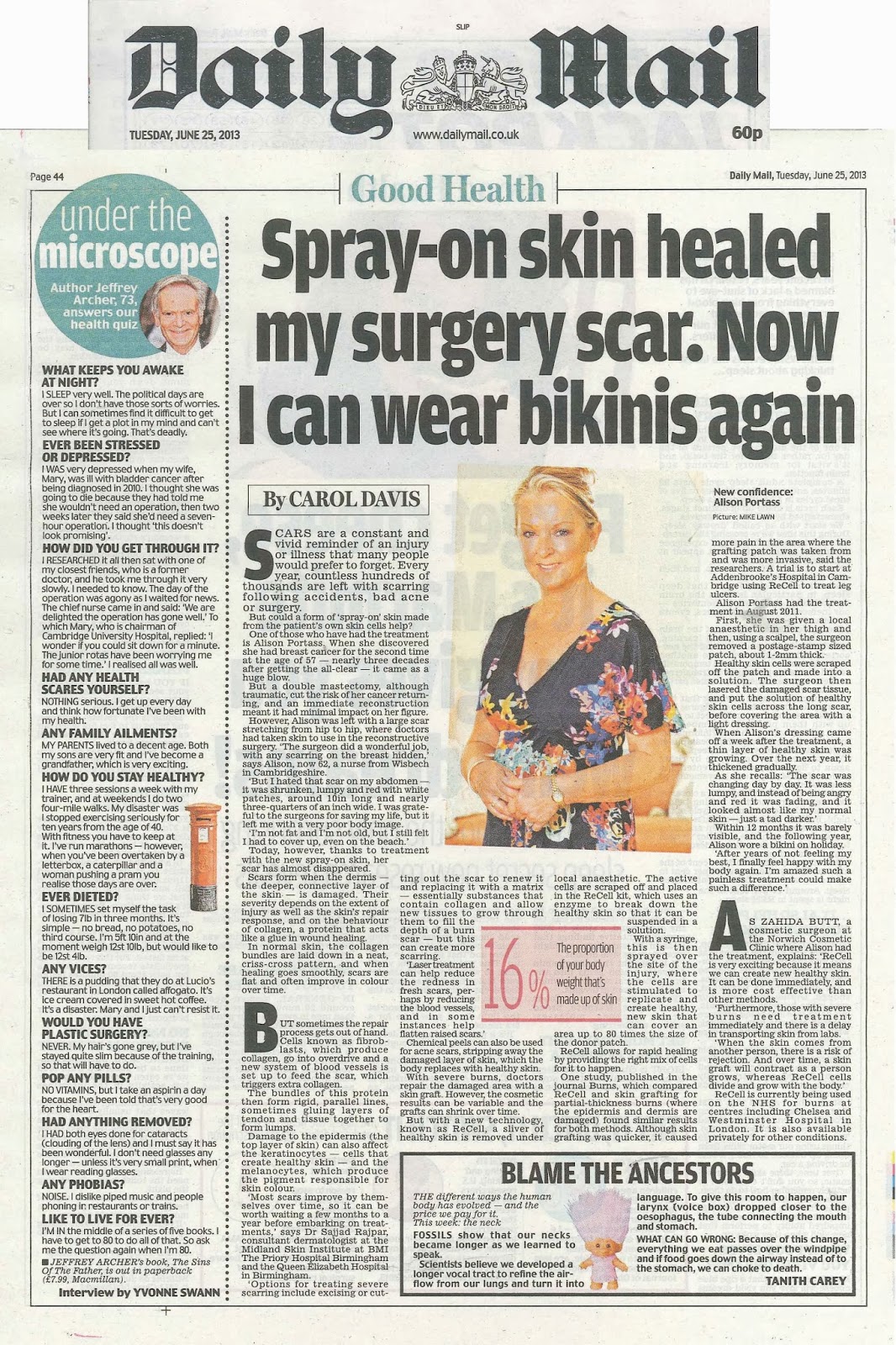 To Infinity And...In Theory SprayOn Skin New Severe Burn Treatment