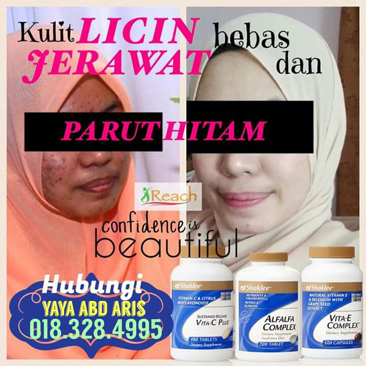 Set jerawat shaklee