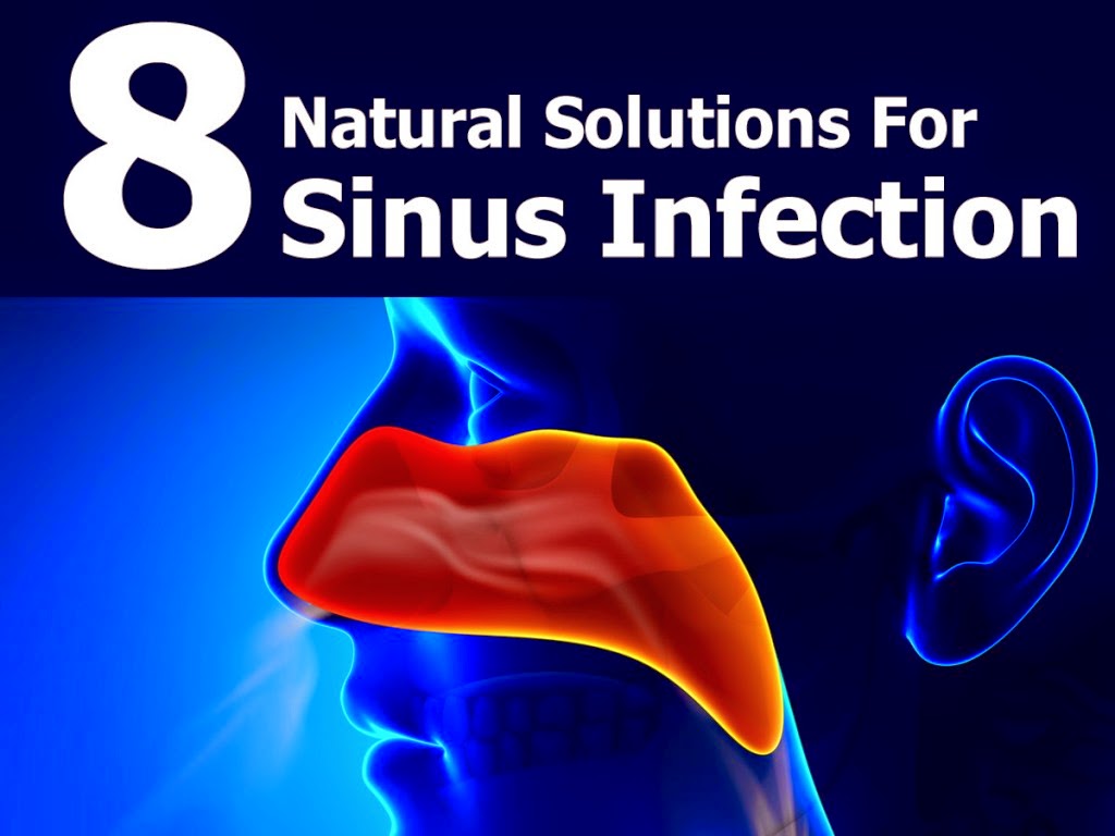 8 Natural Solutions For Sinus Infection Mzizi Mkavu