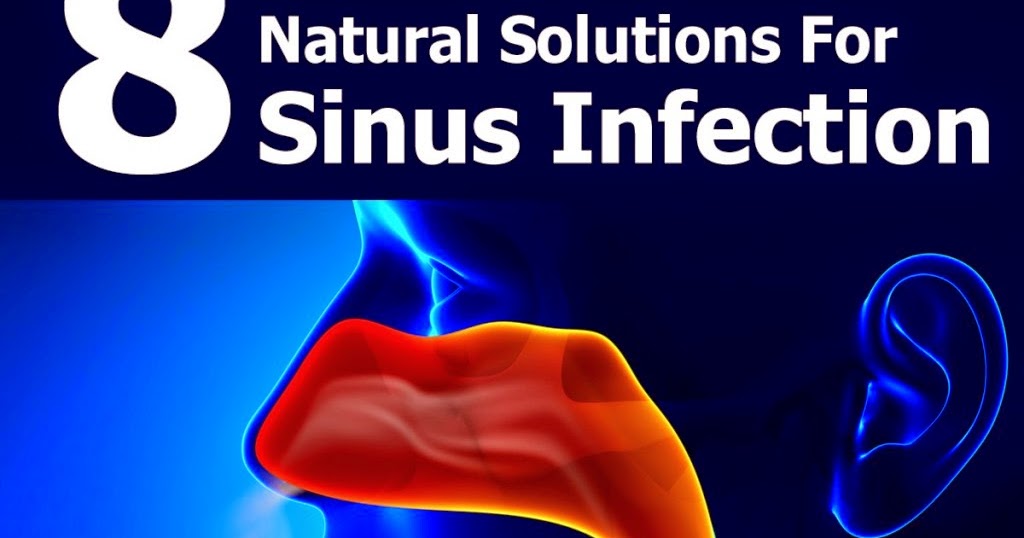 8 Natural Solutions For Sinus Infection Mzizi Mkavu
