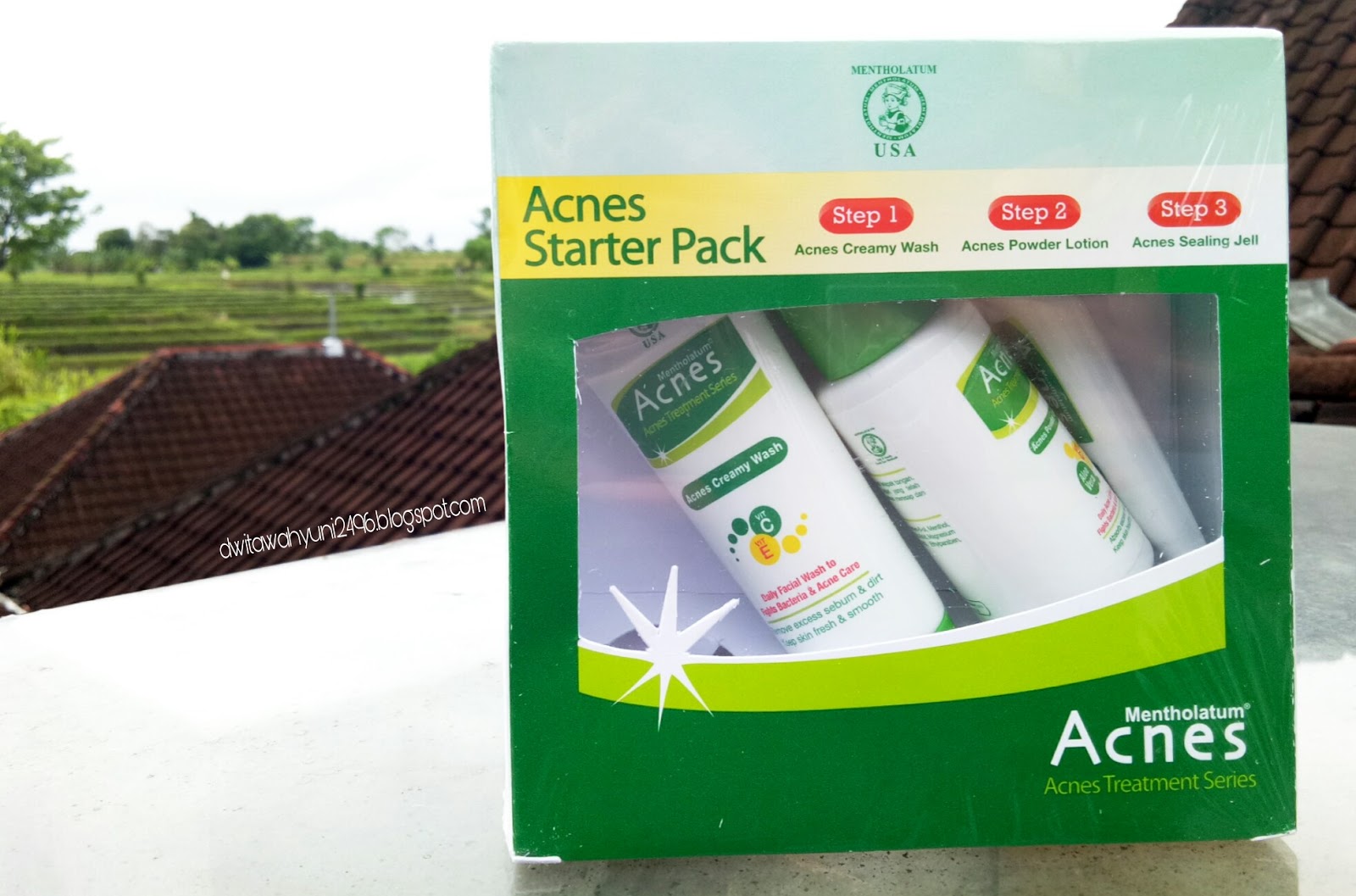 Get Acnes Creamy Wash Palsu
 Pictures