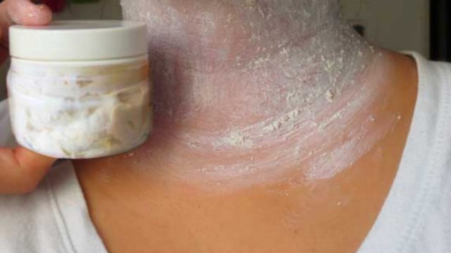  Dark Aareas On The Neck, Armpits and Between Legs In Just 15 Minutes