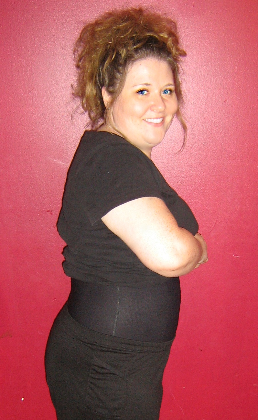 AbdominoplastyMy personal journey