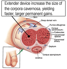 How Penis Pal Penis Extender Device Work?