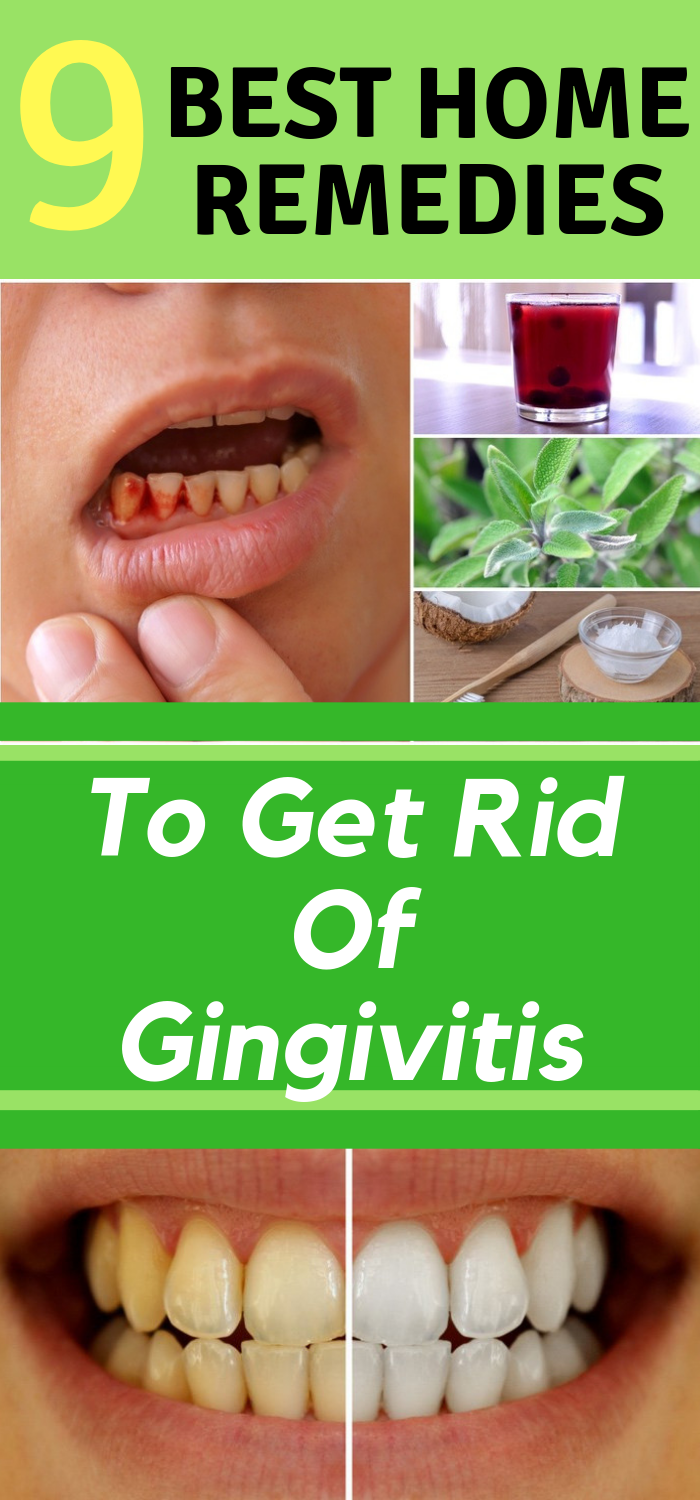 Run Healthy Lifestyle 9 Best Home Remedies To Get Rid Of Gingivitis