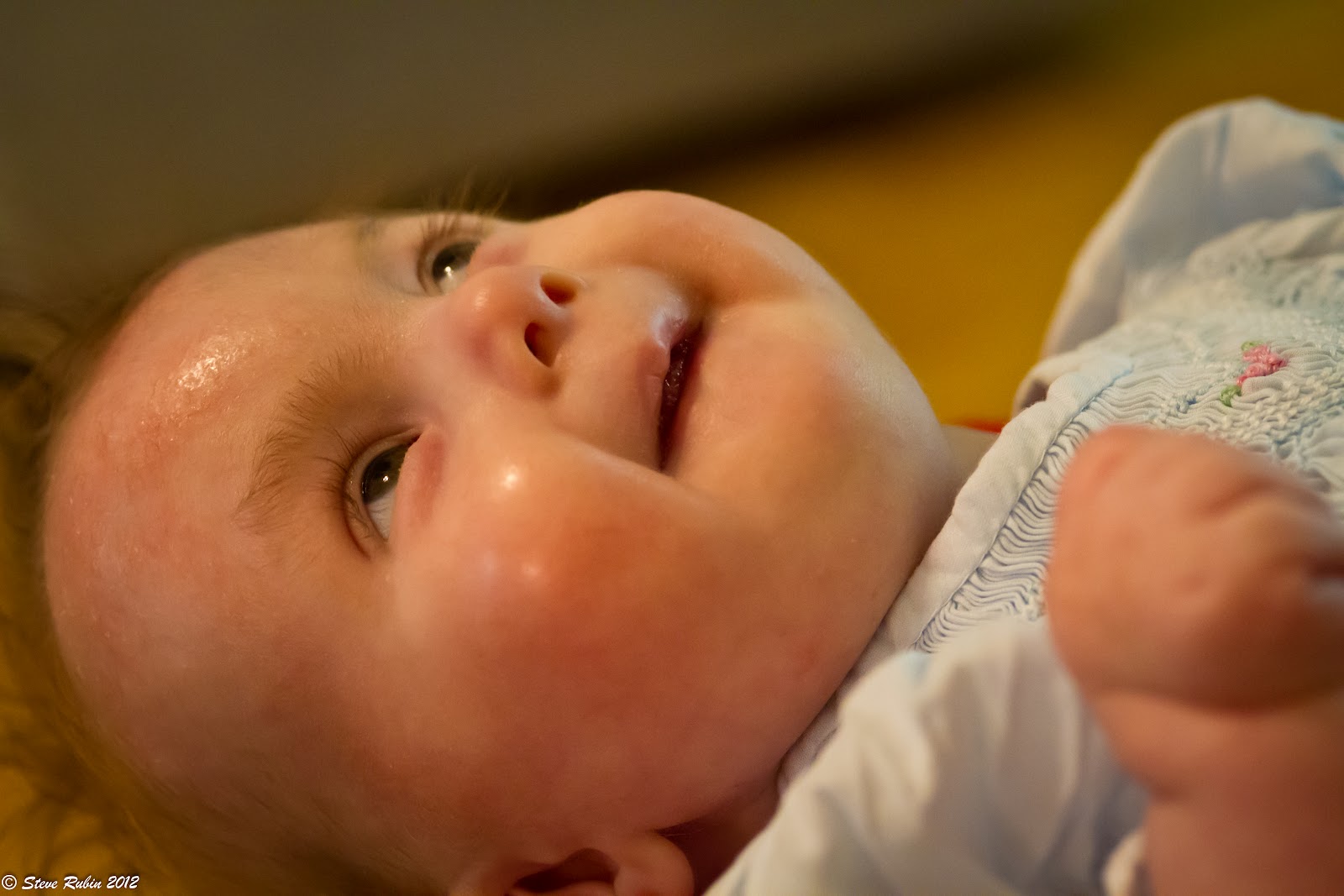 Pray For Lilly Lilly's Trisomy 18 physical features Part 2