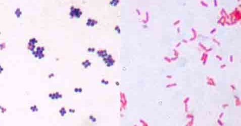 Mengapa Bakteri Gram Positif Berwarna Ungu - Dulajar
